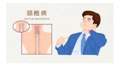 불면증에 대해서? 경추의 원인을 생각해 보셨나요?